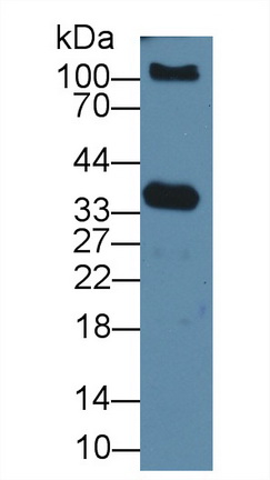 Polyclonal Antibody to Prostate Specific Antigen (PSA)