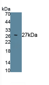 Polyclonal Antibody to Prostate Specific Antigen (PSA)