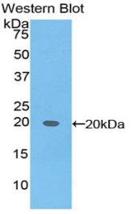 Polyclonal Antibody to Alpha-Fetoprotein (AFP)