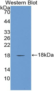 Biotin-Linked Polyclonal Antibody to Alpha-Fetoprotein (AFP)