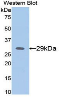 Polyclonal Antibody to Alpha-Fetoprotein (AFP)