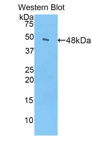 Polyclonal Antibody to Alpha-Fetoprotein (AFP)