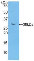 Polyclonal Antibody to Carbohydrate Antigen 125 (CA125)