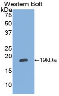 Polyclonal Antibody to Alpha 2-Antiplasmin (a2PI)