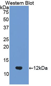 Polyclonal Antibody to Ubiquitin (Ub)