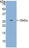 Polyclonal Antibody to Pepsinogen A (PGA)