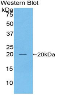 Polyclonal Antibody to Prostatic Acid Phosphatase (PAP)