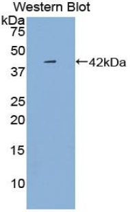 Polyclonal Antibody to Platelet Factor 4 (PF4)