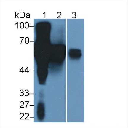 Polyclonal Antibody to Alpha-2-Heremans Schmid Glycoprotein (AHSG)