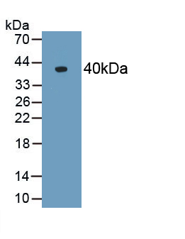 Polyclonal Antibody to Alpha-2-Heremans Schmid Glycoprotein (AHSG)