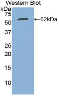 PAA178Hu02.jpg