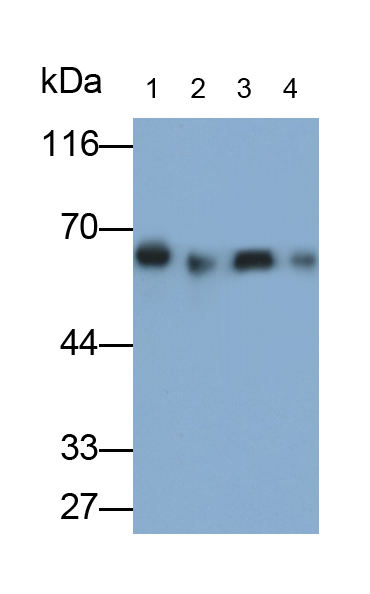 Polyclonal Antibody to Alpha-2-Heremans Schmid Glycoprotein (AHSG)