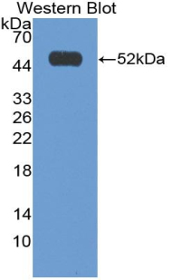 Polyclonal Antibody to Interferon Alpha 2 (IFNa2)