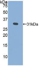 Polyclonal Antibody to Galactosidase Alpha (GLa)