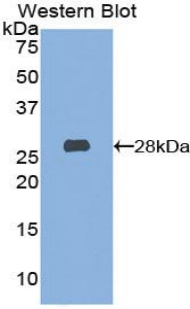 Polyclonal Antibody to Hexosaminidase A Alpha (HEXa)