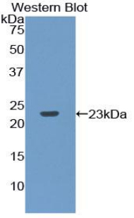 Polyclonal Antibody to Ribonuclease P (RNASEP)