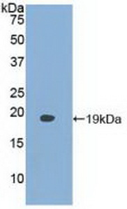 PAA199Hu01.jpg