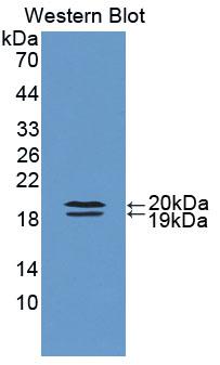 Polyclonal Antibody to Fatty Acid Binding Protein 9, Testis (FABP9)