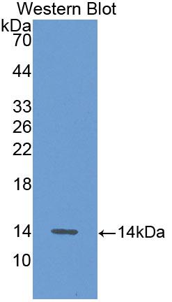 Polyclonal Antibody to Alanine Aminotransferase (ALT)