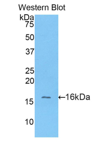 Polyclonal Antibody to Alanine Aminotransferase (ALT)