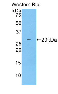 Polyclonal Antibody to Alanine Aminotransferase (ALT)