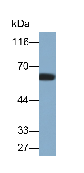 Polyclonal Antibody to Pyruvate kinase isozymes R/L (PKLR)