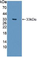 Polyclonal Antibody to Collagen Type I Alpha 2 (COL1a2)