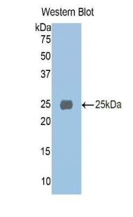 Polyclonal Antibody to Alpha-1-Microglobulin (a1M)