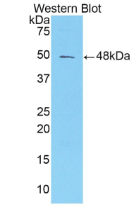 Polyclonal Antibody to Alpha-1-Microglobulin (a1M)