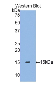 Polyclonal Antibody to Transforming Growth Factor Beta 2 (TGFb2)