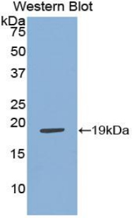 Polyclonal Antibody to Adrenomedullin (ADM)