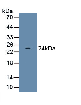 Polyclonal Antibody to Interferon Beta (IFNb)