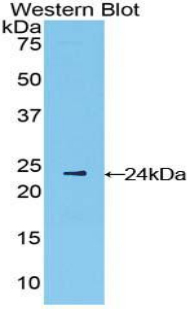 Polyclonal Antibody to Interferon Beta (IFNb)