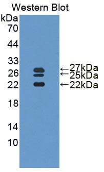 Polyclonal Antibody to Interleukin 1 Receptor Antagonist (IL1RA)