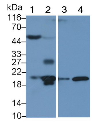 Polyclonal Antibody to Interleukin 1 Receptor Antagonist (IL1RA)