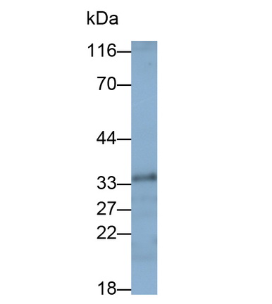 Polyclonal Antibody to Free Fatty Acid Receptor 3 (FFAR3)