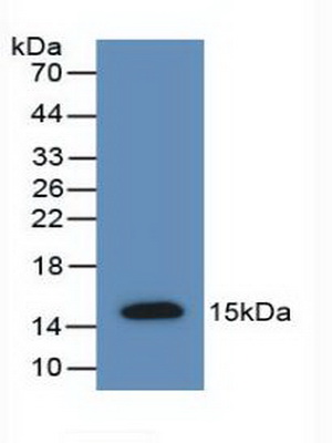 Polyclonal Antibody to Anti-Mullerian Hormone (AMH)