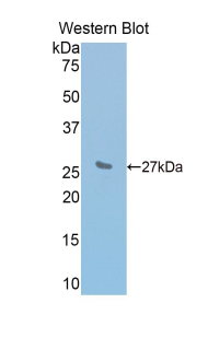 Polyclonal Antibody to Interleukin 2 Receptor Beta (IL2Rb)