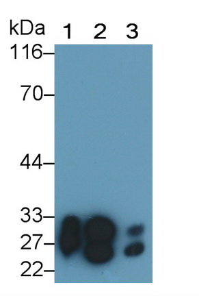 Polyclonal Antibody to Protease, Serine 1 (PRSS1)