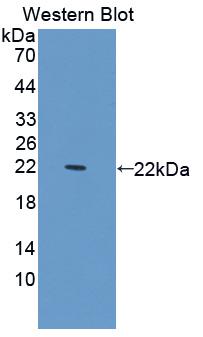 Polyclonal Antibody to Complement 1 Inhibitor (C1INH)