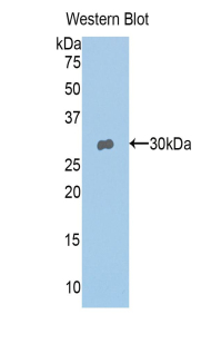 Polyclonal Antibody to Tyrosinase (TYR)