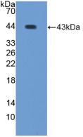 Polyclonal Antibody to WAP Four Disulfide Core Domain Protein 2 (WFDC2)