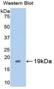 Polyclonal Antibody to Caspase 2 (CASP2)