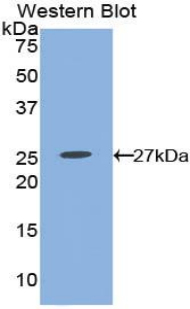 Polyclonal Antibody to Prostaglandin E Receptor 2 (EP2)