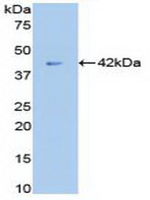 Polyclonal Antibody to Beta-2-Microglobulin (b2M)