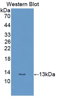 Polyclonal Antibody to Beta-2-Microglobulin (b2M)