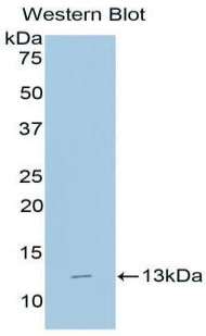 FITC-Linked Polyclonal Antibody to Beta-2-Microglobulin (b2M)