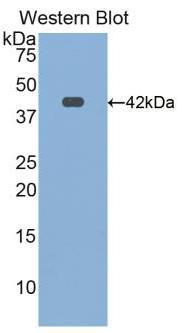 Polyclonal Antibody to Transferrin Receptor 2 (TFR2)