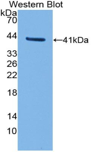 Polyclonal Antibody to Transferrin Receptor 2 (TFR2)