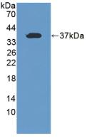 Polyclonal Antibody to Transferrin Receptor 2 (TFR2)